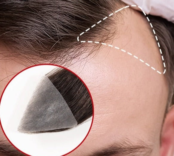 Patchs capillaires Temple pour hommes femmes | Couvrir les tempes chauves