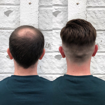 Top Ten Most Asked Question of Hair System