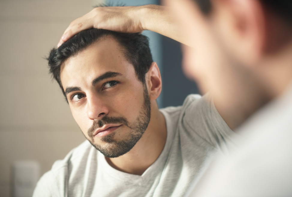 Male Pattern Baldness and Treatments