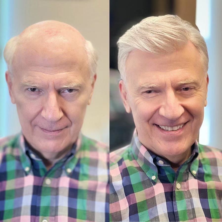 Férfi Tupé Hollywood Stílus | Francia csipkés tupé vékony bőr peremmel és csipkés előlappal