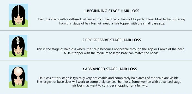 Mono koronka topper damski, prawdziwe włosy Remy, zamknięcie górne, ciemny blond trwały 27/613#