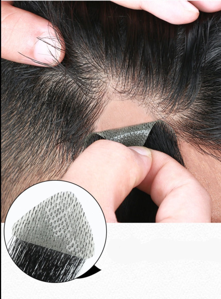 Temple Hair Patches for Men Women 2 pieces