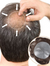 Crown Hair Patch | Covering Balding or Thinning Crown