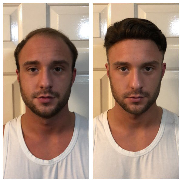 hair system before after