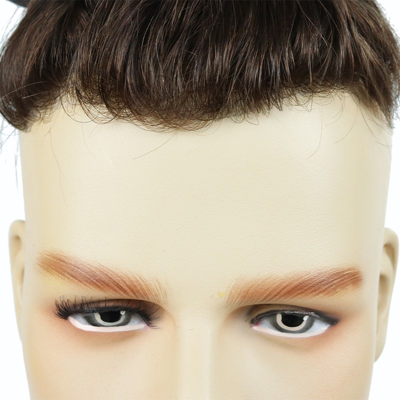 Vikende hårfeste-patch | Dekker vikende hårfeste og toppen av hodet