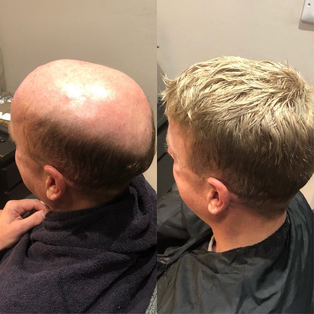 0,06-0,08mm supertynn full skin-base herrehårdel | Lett bølgete tupé for menn