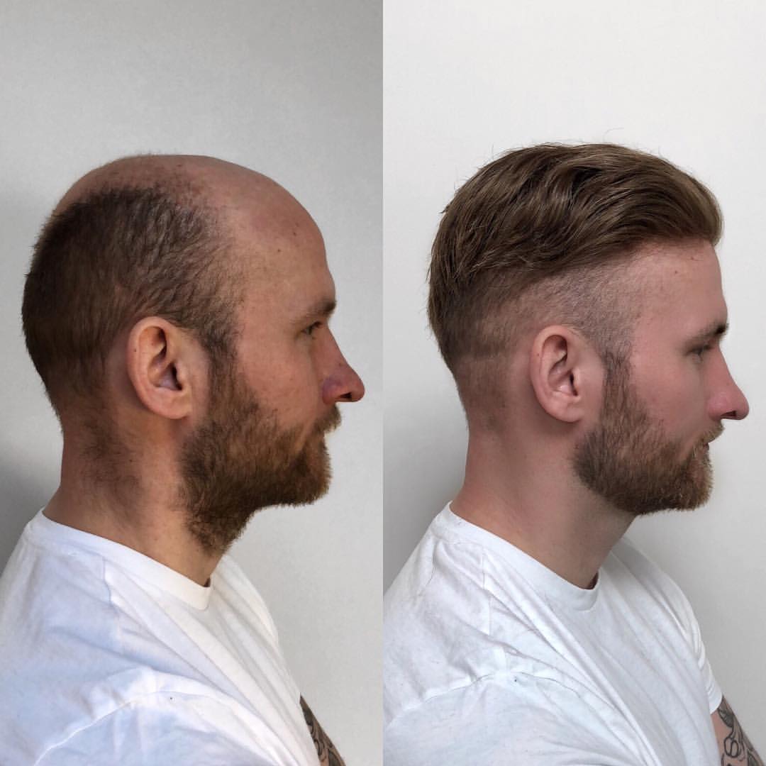 Natural Men's French Lace Australia Style Toupee with Poly Skin Perimeter - product view
