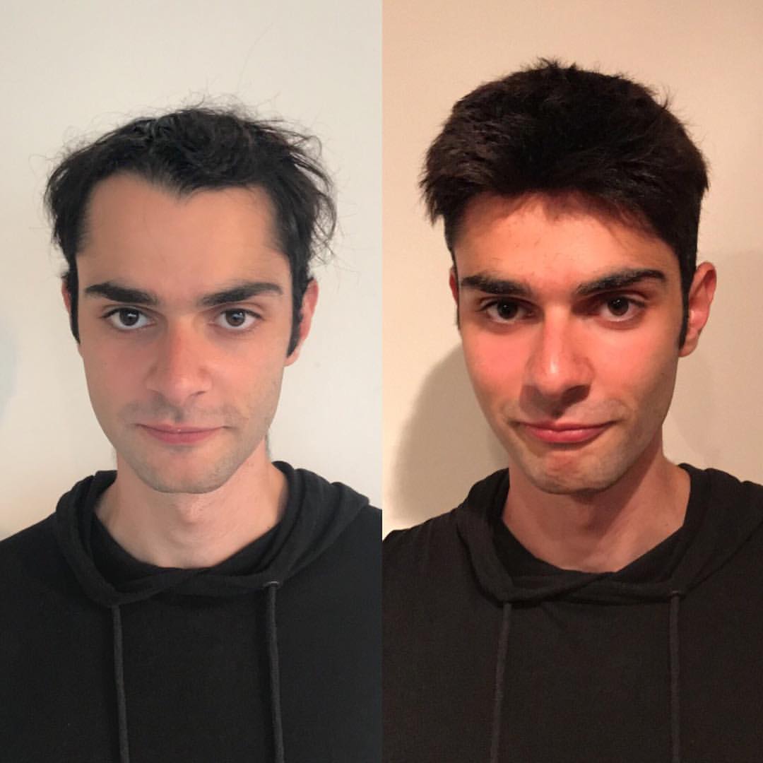 0,08-0,10 mm Pełna cienka baza z lekką falą – tupet męski | Męskie systemy włosów