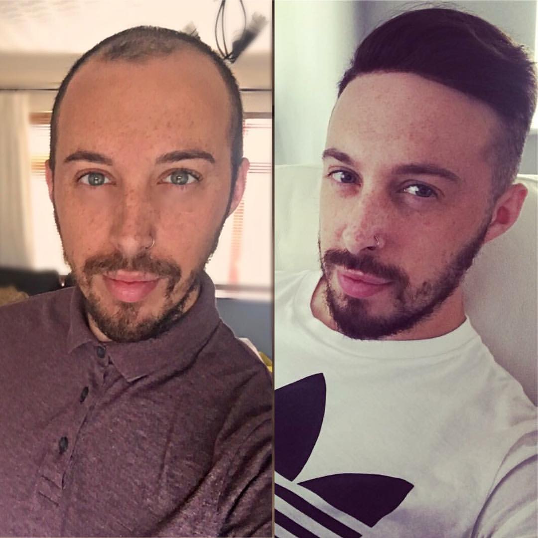 Finom mono hajdarab PU kivágásokkal, francia csipke homlokkal | Férfi póthajak