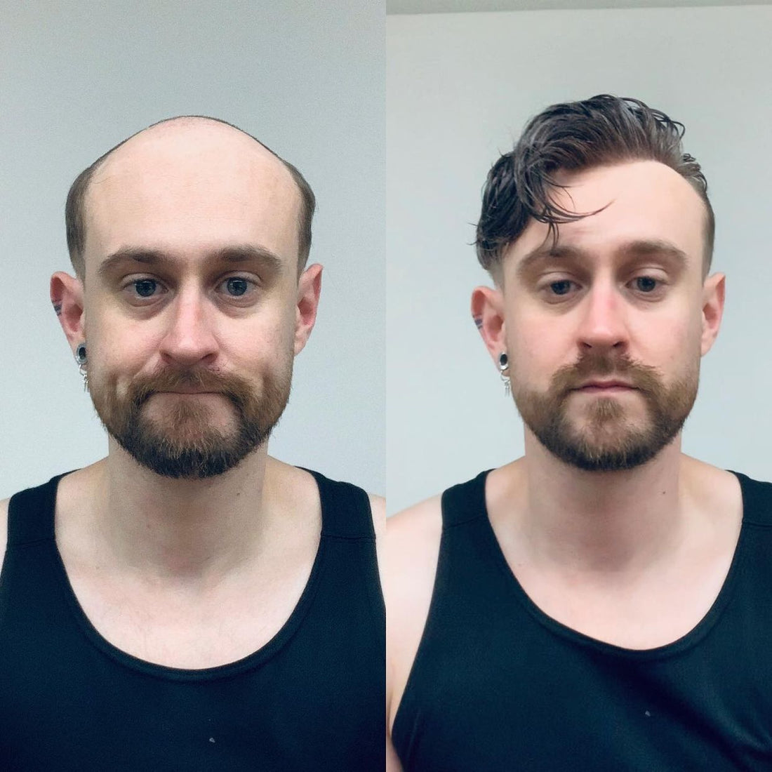 Fine Mono with Thin Skin French Lace Front VER | Men's Toupee