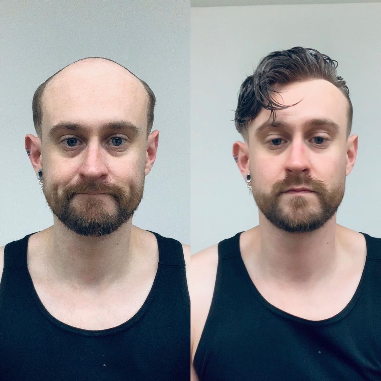 Mono fino con frente de encaje francés de piel fina | Tupé de hombre