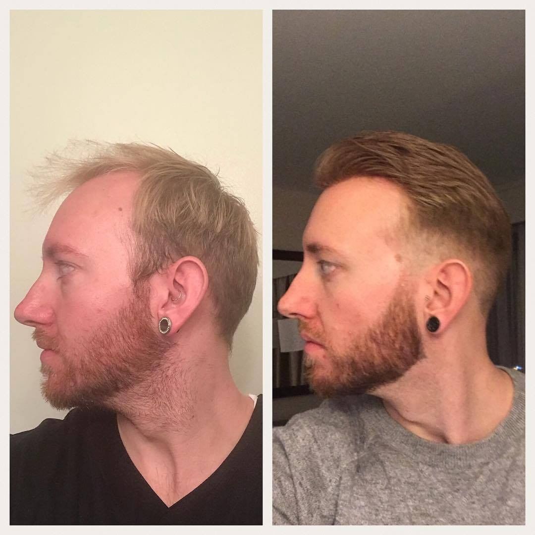 French Lace Toupees with Skin Back and Sides - product view