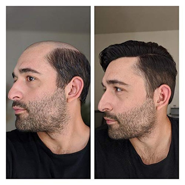 Base de piel delgada para hombre con peluquín y frente de encaje francés | Sistema de cabello duradero para hombres