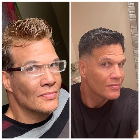 hair toupee before after