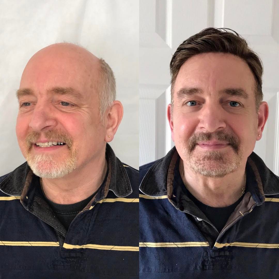 Strong and Durable Mono Men's Hairpieces | Fine Mono with PU Perimeter Men's Hair System