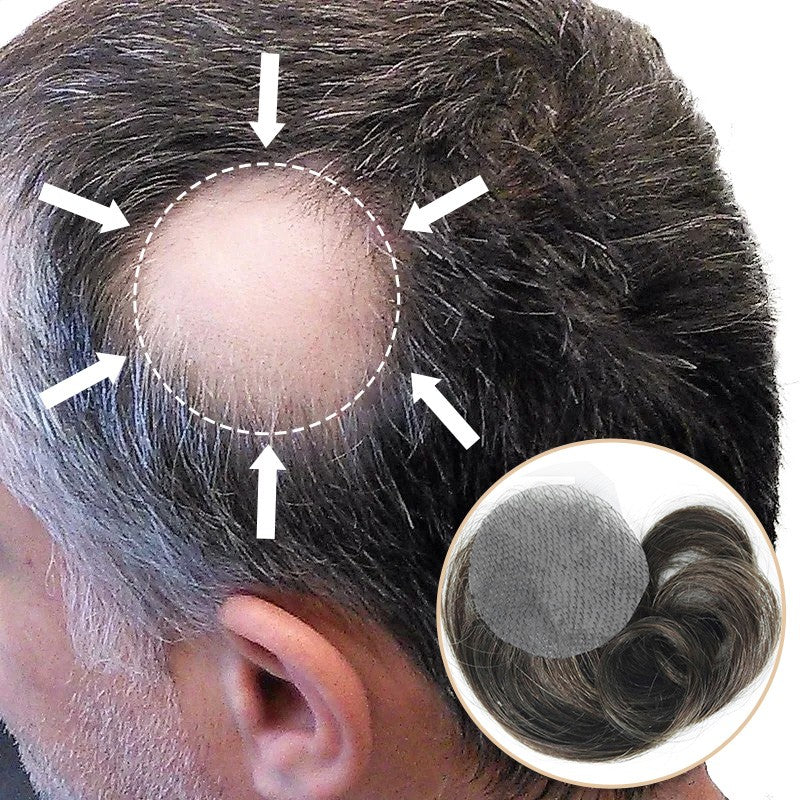 Side/Back Hair Patches for Men Covering Bald Spots