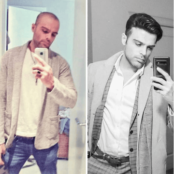 hair unit before after