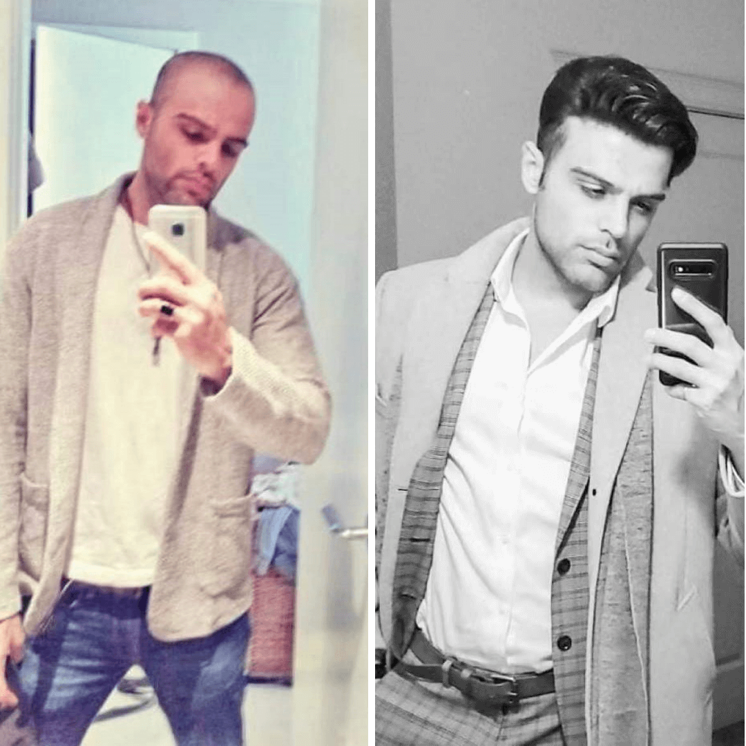 hair unit before after