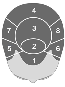 Custom Hair Replacement Systems For Men